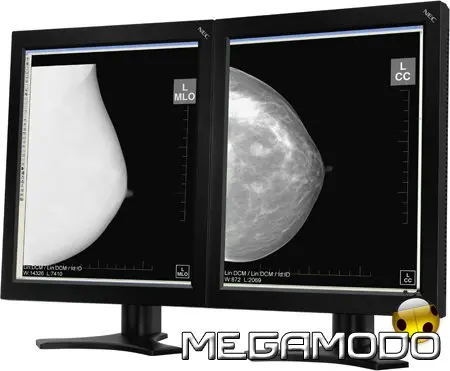 NEC MD205MG, per la refertazione radiologica in mammografia