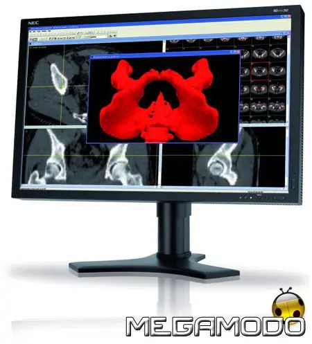 Nec MDview 262 Medical Imaging, in formato Wide