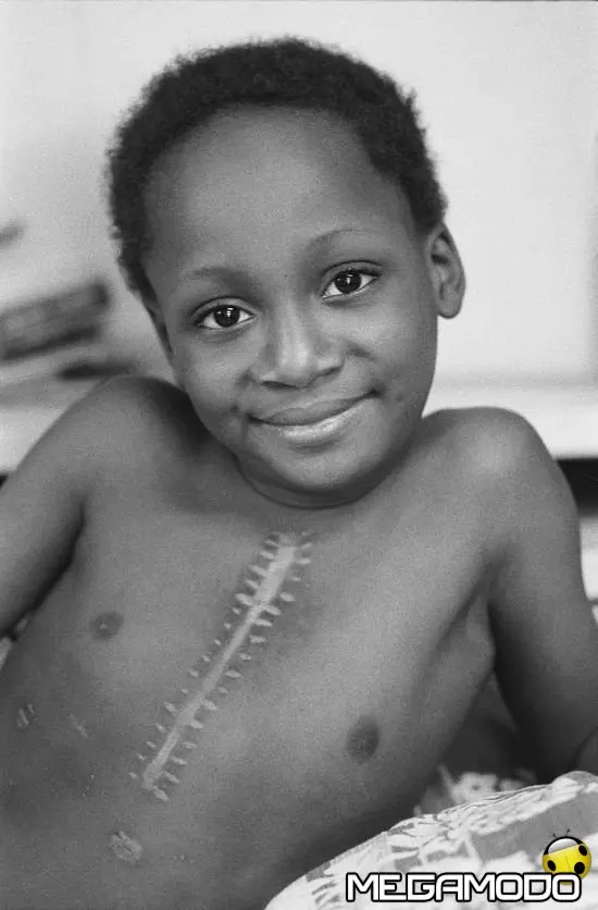 Parte l'SMS solidale per salvare i bambini cardiopatici