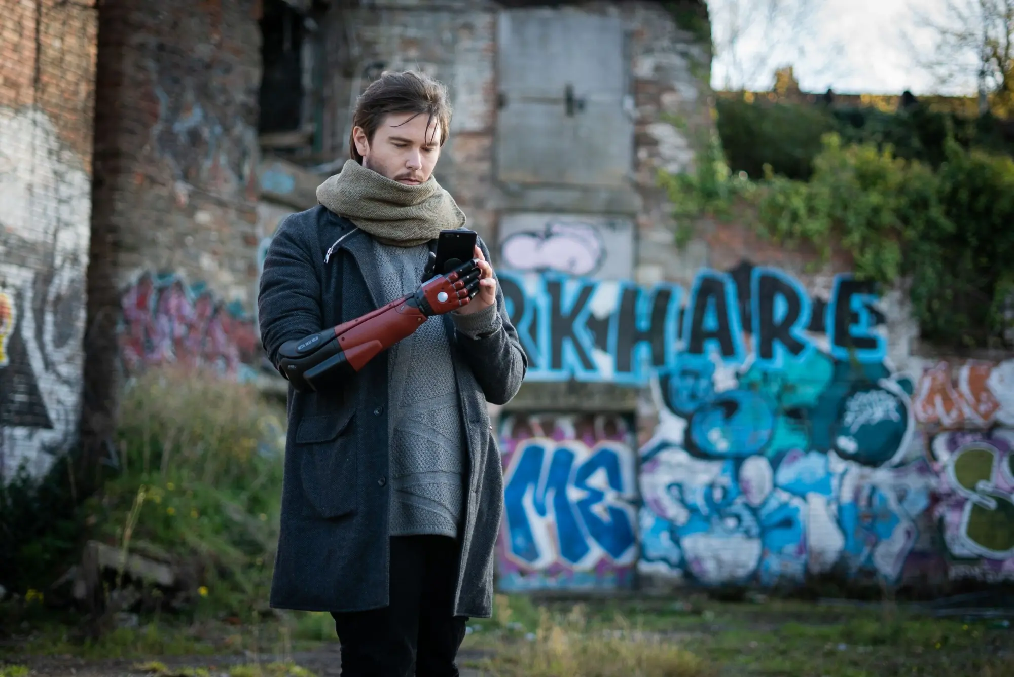 Braccio bionico: un ragazzo inglese riceve la protesi di Metal Gear Solid